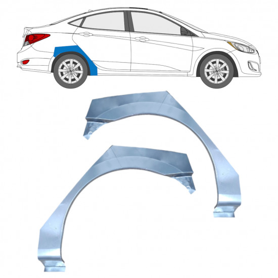 Takalokasuoja korjaussarja varten Hyundai Accent 2010- / Vasen / Oikea / Vasen / Oikea 12804